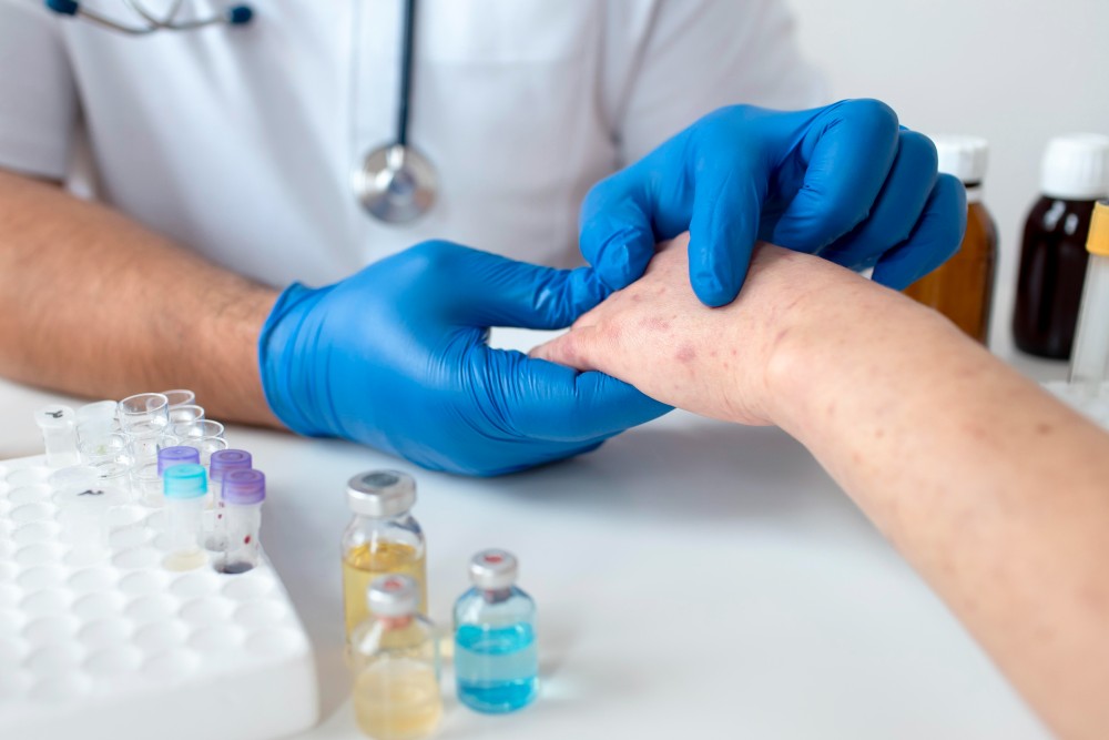 Allergy Skin Tests