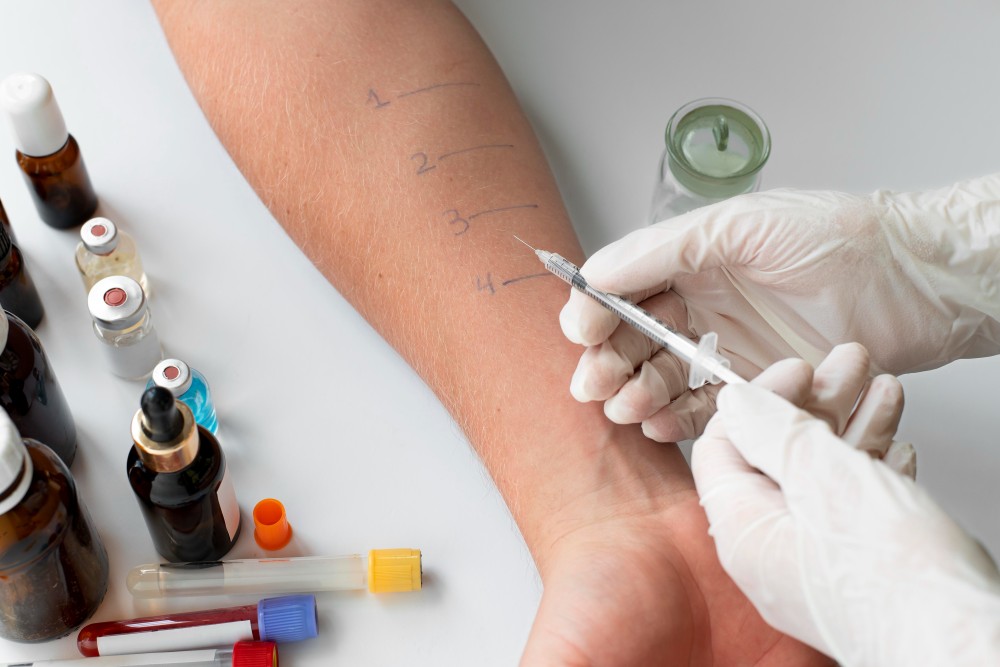 Allergy Testing in Houston